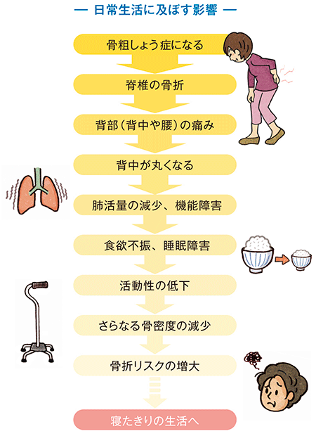 日常生活に及ぼす影響