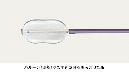 バルーン（風船）状の手術器具を膨らませた形