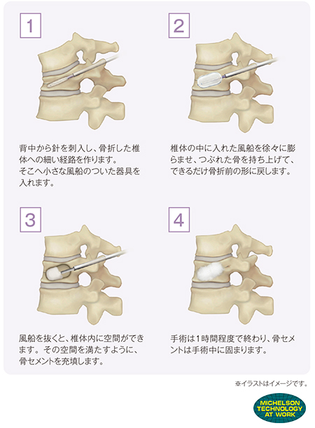 手術方法