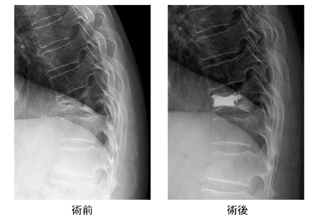 手術方法